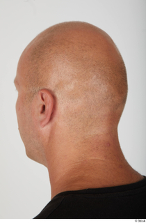 Photos Bobby Hyde bald head 0003.jpg